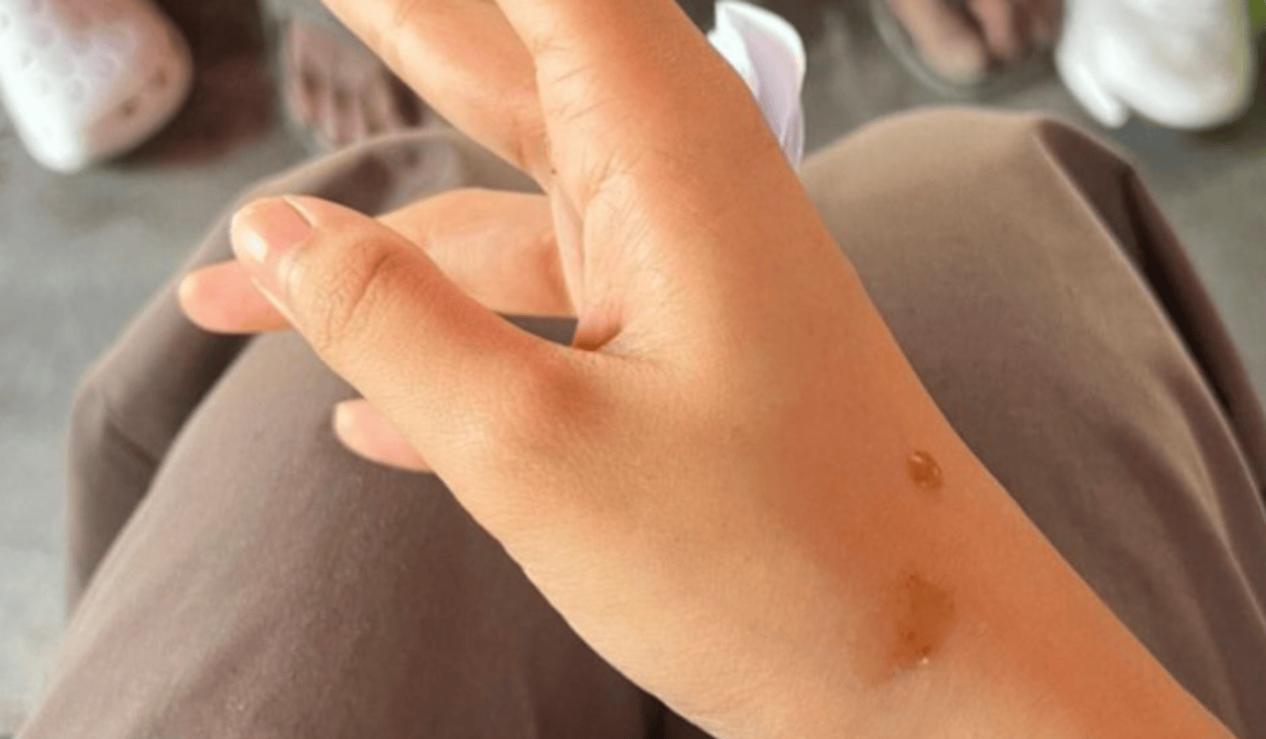 ‘Ketchup modus’ nearly targets student inside the jeepney in Laguna — Old trick or growing threat?